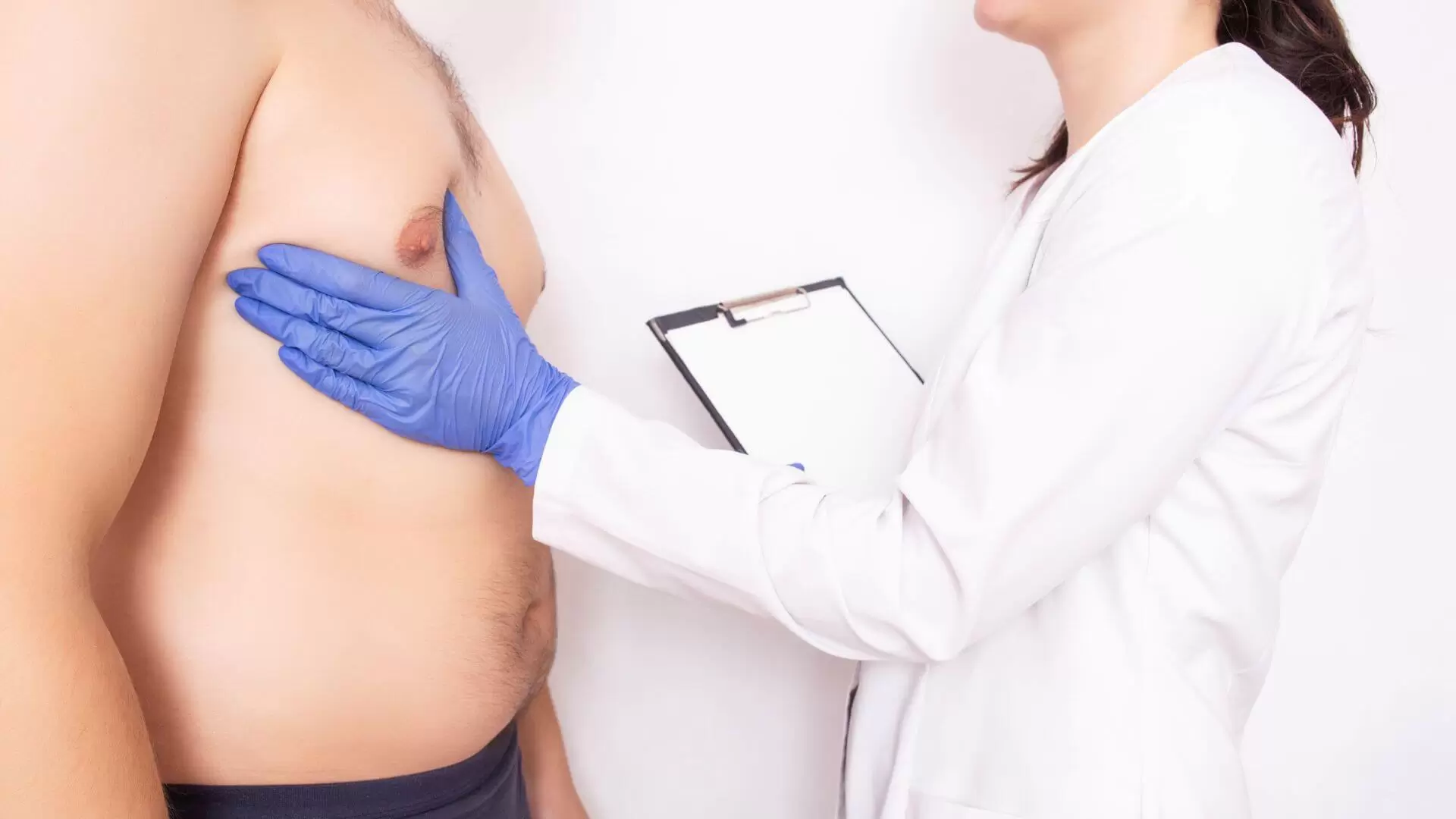 Everything You Need To Know About Gynecomastia (1)