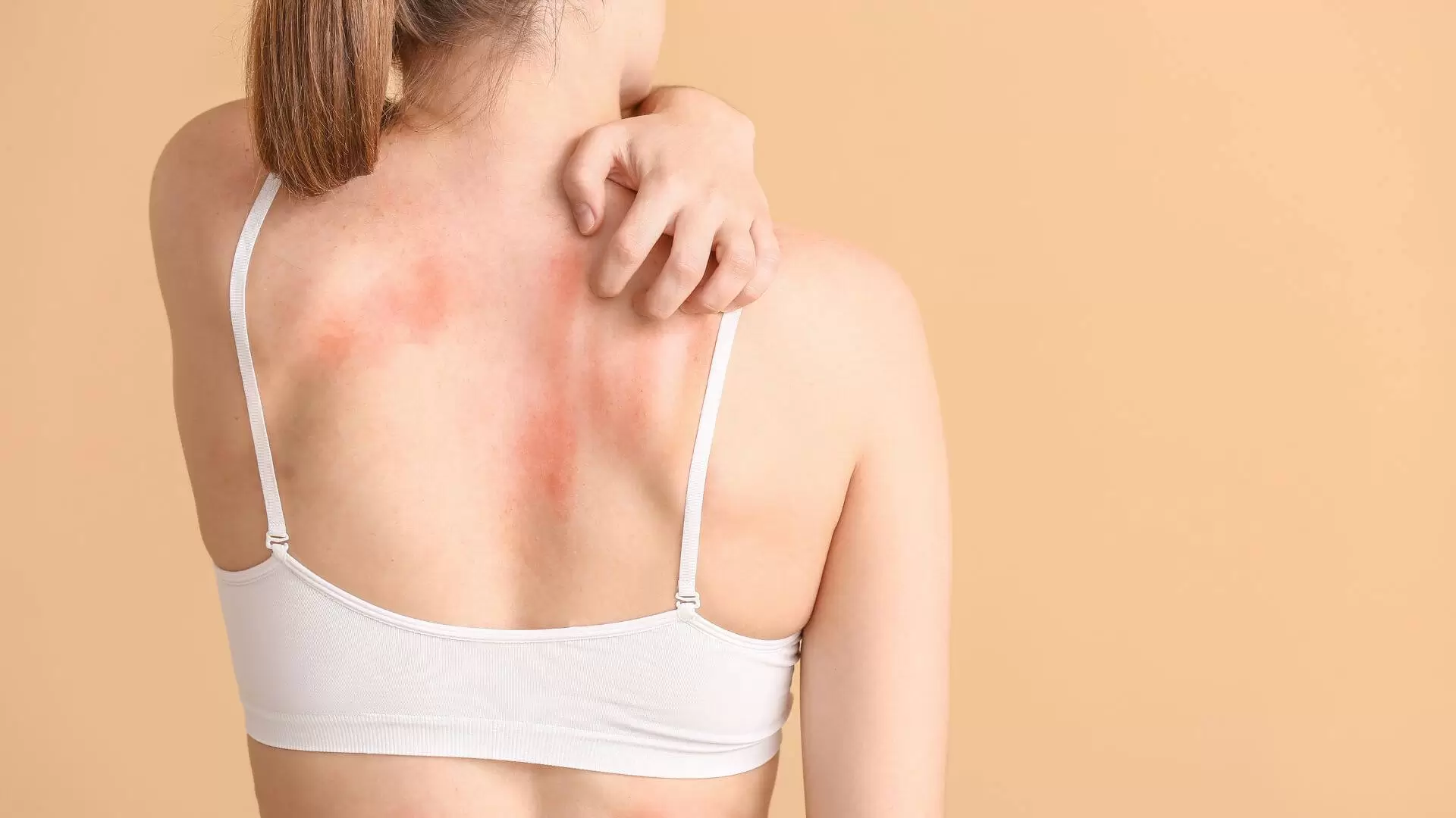 Do you Recognize The Signs of Skin Suffering From oxidative Stress (1)
