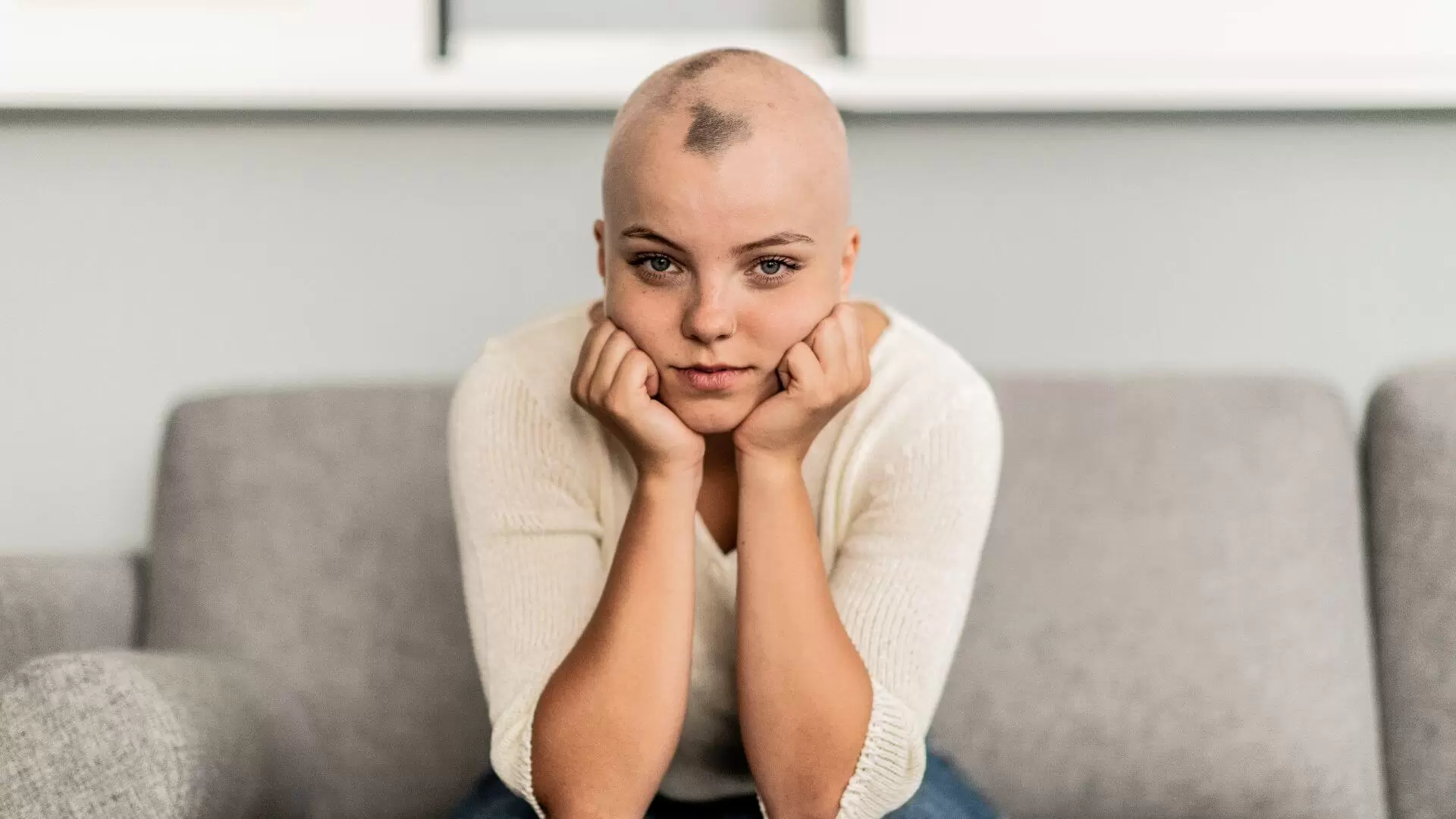 Does Gray Hair Increase The Risk of Alopecia (1)