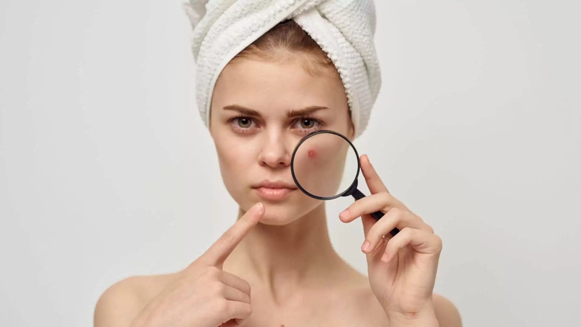5 mistakes in covering up acne – what to do to make them disappear, the makeup artist will say (1)