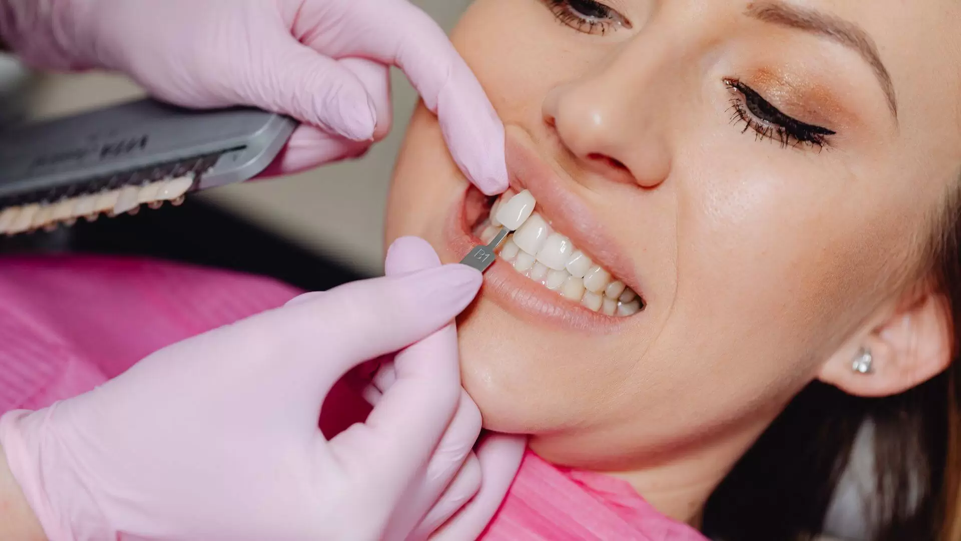 Do You Wear Veneers These Are The Best Tips For Your Care (1)