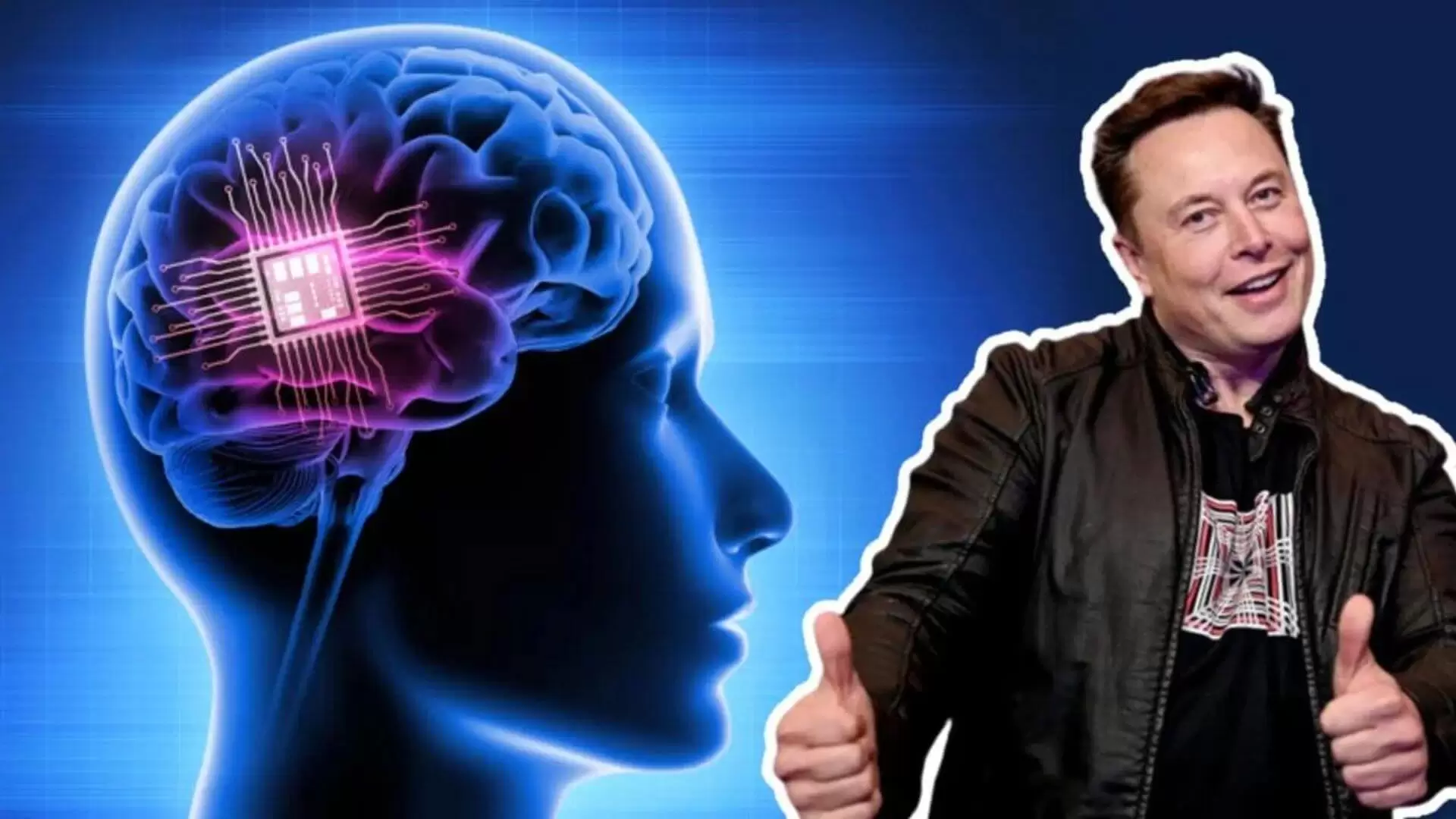 Elon Musk Says Neuralink Will Start Implanting Brain Chips In Humans In 2022 (1)